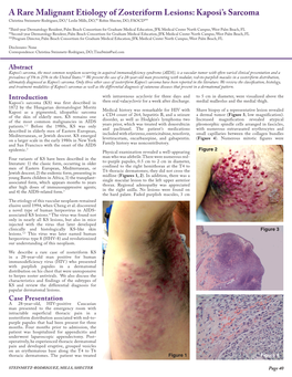 A Rare Malignant Etiology of Zosteriform Lesions: Kaposi's