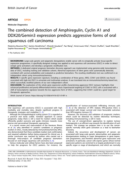 The Combined Detection of Amphiregulin, Cyclin A1 and DDX20/Gemin3 Expression Predicts Aggressive Forms of Oral Squamous Cell Carcinoma