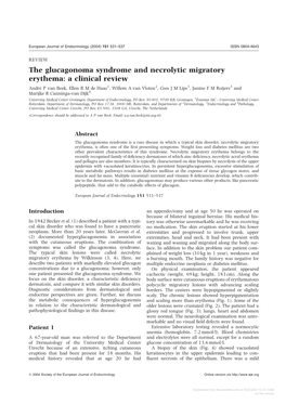 The Glucagonoma Syndrome And