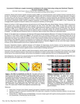 Proc. Intl. Soc. Mag. Reson. Med. 22 (2014) 0160