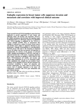 Endoglin Expression in Breast Tumor Cells Suppresses Invasion and Metastasis and Correlates with Improved Clinical Outcome