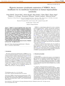 Hypoxia Increases Cytoplasmic Expression of NDRG1, but Is Insuﬃcient for Its Membrane Localization in Human Hepatocellular Carcinoma