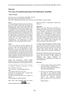 Two Cases of Accidental Poisoning with Zamioculcas Zamiifolia