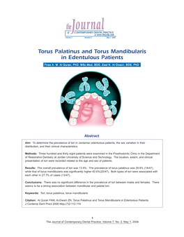 Torus Palatinus and Torus Mandibularis in Edentulous Patients