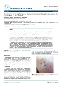 Coexistence of Lymphangioma Circumscriptum and Angiokeratoma