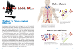 Chylous Vs. Pseudochylous Effusions