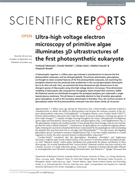 Ultra-High Voltage Electron Microscopy of Primitive Algae Illuminates 3D