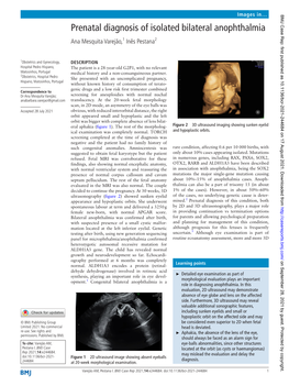 Prenatal Diagnosis of Isolated Bilateral Anophthalmia Ana Mesquita Varejão,1 Inês Pestana2