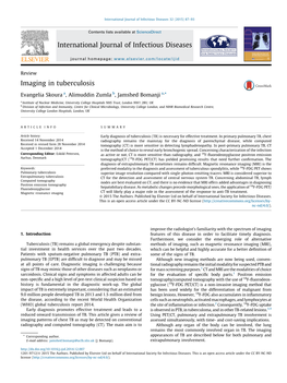 Imaging in Tuberculosis