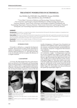 Treatment Posibilities in Ectromelia