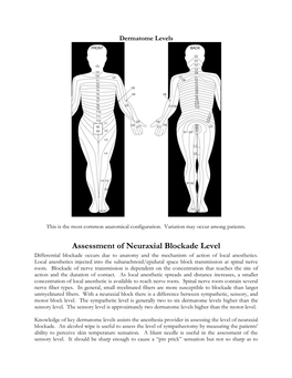 Assessment of Neuraxial Blockade Level Differential Blockade Occurs Due to Anatomy and the Mechanism of Action of Local Anesthetics