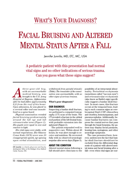 Facial Bruising and Altered Mental Status After a Fall