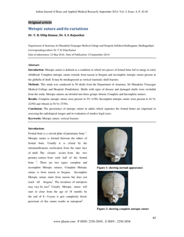 Metopic Suture and Its Variations Dr