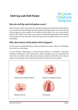 Cleft Lip and Cleft Palate