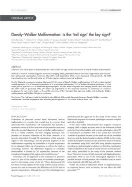 Dandy–Walker Malformation: Is the 'Tail Sign'