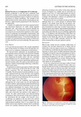 600 Sir, Retinal Cryotherapy Is Now the Most Commonly Used