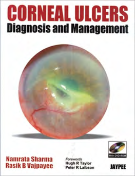 CORNEAL ULCERS Diagnosis and Management