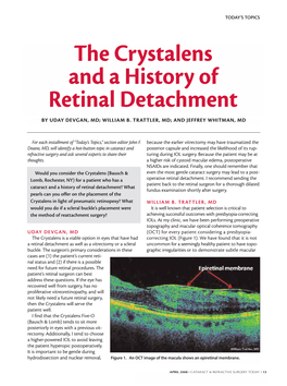 The Crystalens and a History of Retinal Detachment by UDAY DEVGAN, MD; WILLIAM B