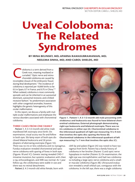 Uveal Coloboma: the Related Syndromes by IRINA BELINSKY, MD; APARNA RAMASUBRAMANIAN, MD; NEELEMA SINHA, MD; and CAROL SHIELDS, MD