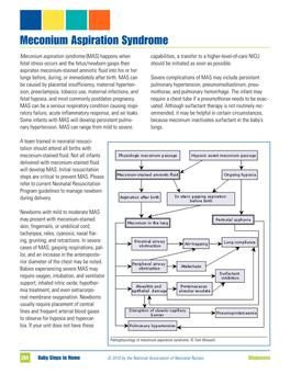 Meconium Aspiration Syndrome