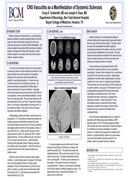 CNS Vasculitis As a Manifestation of Systemic Sclerosis Corey E