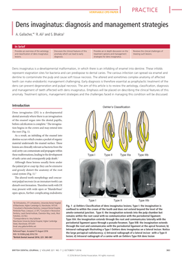 Dens Invaginatus: Diagnosis and Management Strategies