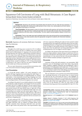 Squamous Cell Carcinoma of Lung with Skull Metastasis: a Case Report