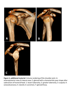 Glenoid with a Characteristic Pear Shape After Subtraction of Humeral Head