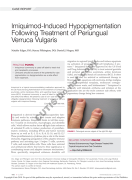 Imiquimod-Induced Hypopigmentation Following Treatment of Periungual Verruca Vulgaris