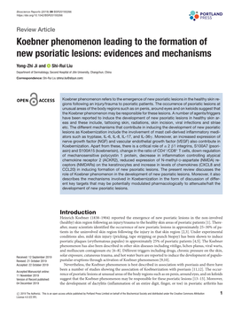 Koebner Phenomenon Leading to the Formation of New Psoriatic Lesions: Evidences and Mechanisms