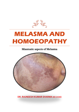 Melasma and Homoeopathy