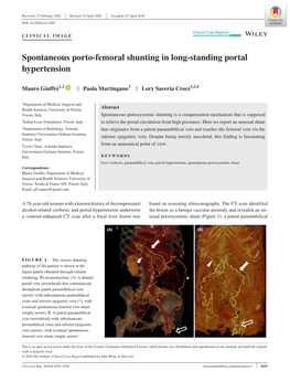 Spontaneous Porto‐Femoral Shunting in Long‐Standing Portal Hypertension