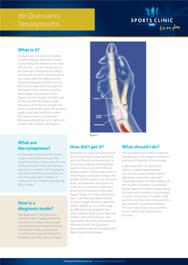 De Quervain's Tenosynovitis