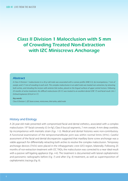 Class II Division 1 Malocclusion with 5 Mm of Crowding Treated Non-Extraction with IZC Miniscrews Anchorage IJOI 41