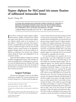 Siepser Slipknot for Mccannel Iris-Suture Fixation of Subluxated Intraocular Lenses