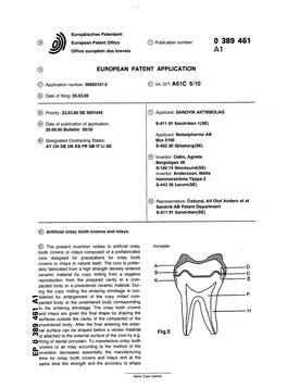 Artificial Onlay Tooth Crowns and Inlays