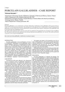 Porcelain Gallbladder – Case Report