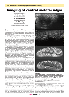 Imaging of Central Metatarsalgia