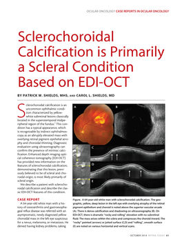 Sclerochoroidal Calcification Is Primarily a Scleral Condition Based on EDI-OCT