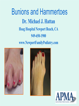 Bunions and Hammertoes Dr