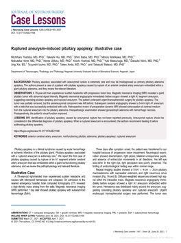 Ruptured Aneurysm–Induced Pituitary Apoplexy: Illustrative Case