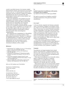 Uveitis Is Most Likely Because of an Immune Complex Hypersensitivity