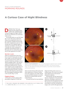 A Curious Case of Night Blindness