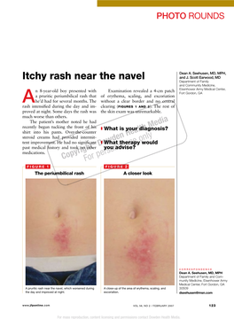 Itchy Rash Near the Navel and J