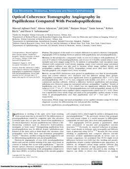 Optical Coherence Tomography Angiography in Papilledema Compared with Pseudopapilledema