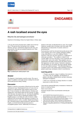 A Rash Localised Around the Eyes