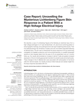 Case Report: Unravelling the Mysterious Lichtenberg Figure Skin Response in a Patient with a High-Voltage Electrical Injury