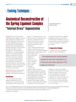 Anatomical Reconstruction of the Spring Ligament Complex “Internal Brace” Augmentation