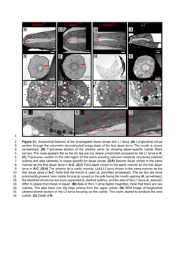 Figure S1. Anatomical Features of the Investigated Dauer Larvae and L1 Larva