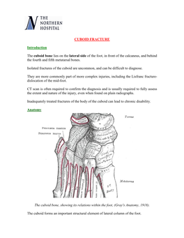 Cuboid Fracture